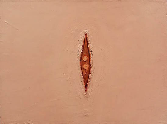 Jinekolog Muhabbetleri: Evli olmayana smear testi yok! | Kaos GL - LGBTİ+ Haber Portalı Haber